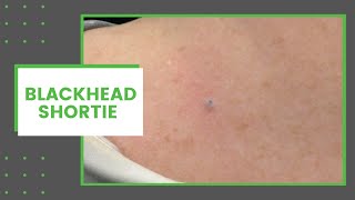Blackhead Shortie | Dr. Derm