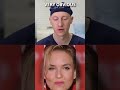 Did Renee Zellweger Have A Blepharoplasty Did Renee Zellweger Have A Blepharoplasty