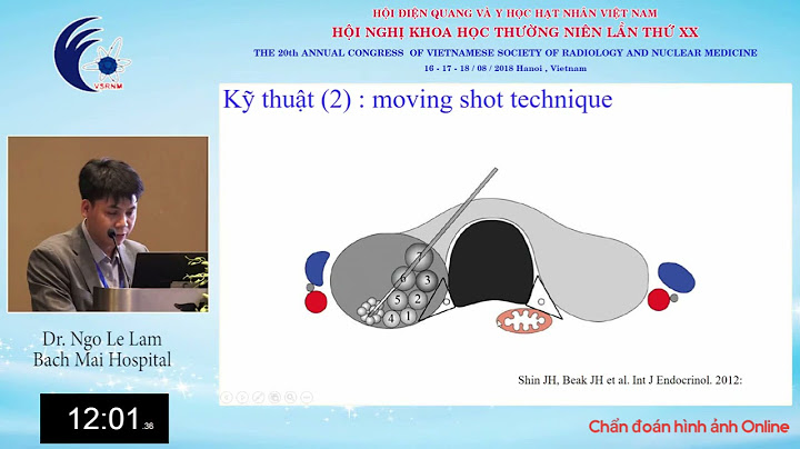 Rfa trong xây dựng là gì năm 2024