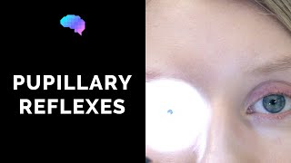 Pupillary Reflexes - OSCE Guide (Clip) | UKMLA | CPSA