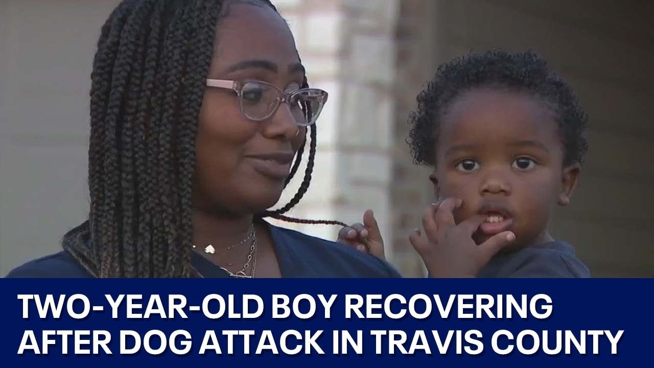 Two-year-old boy recovering after dog attack in Travis County | FOX 7 ...