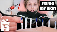 I Tried Acupuncture & Chinese Medicine to Heal My Acne | Vlogmas Day 11