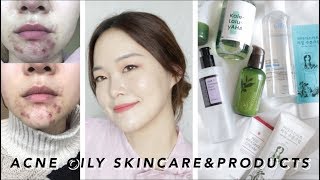 Basic Skincare & Products for ACNE, OILY Skin! | 여드름, 지성피부 스킨케어 & 추천 제품!