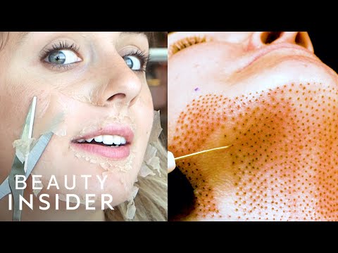 11 Grossly Satisfying Beauty Treatments For Better Skin | Beauty Insider