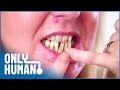 My Husband Has Never Seen My Teeth | Extreme Smile Makeover | Only Human