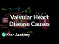 Valvular heart disease causes | Circulatory System and Disease | NCLEX-RN | Khan Academy