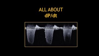 All about: DP/DT (Echocardiography)!