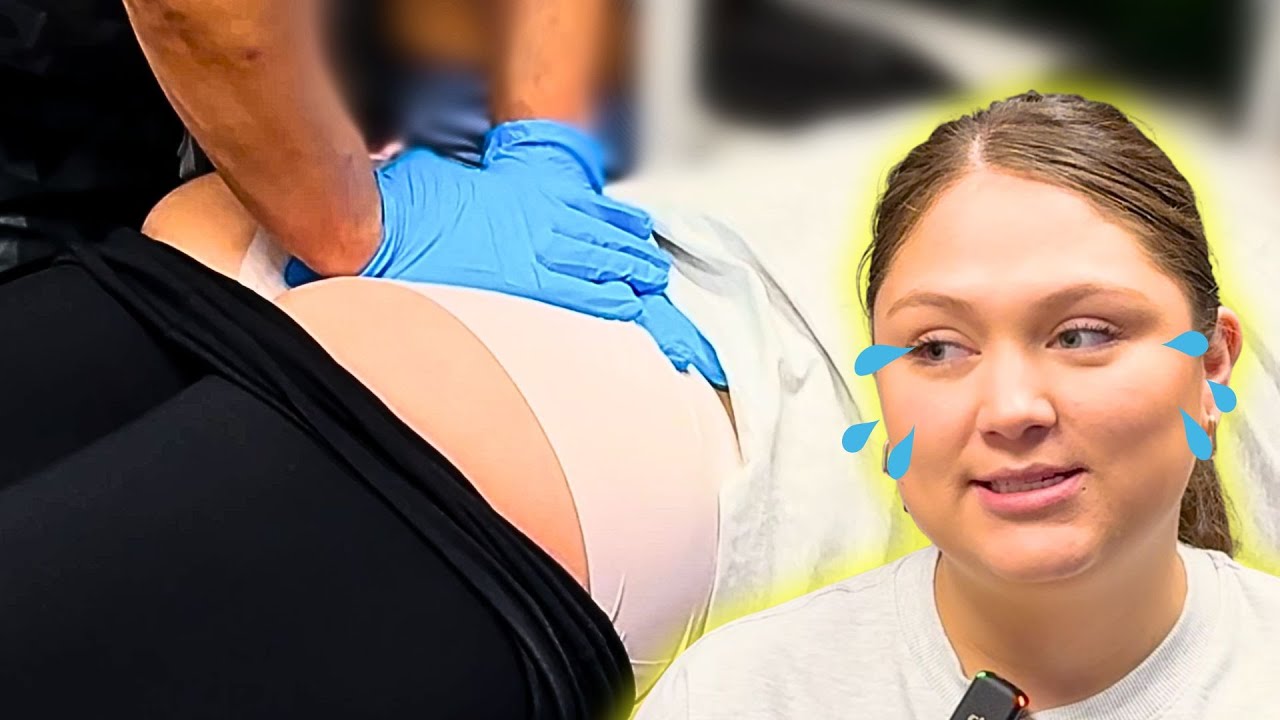 Tailbone COCCYX  Adjustment | Avoided Surgery | Couldn't Sit