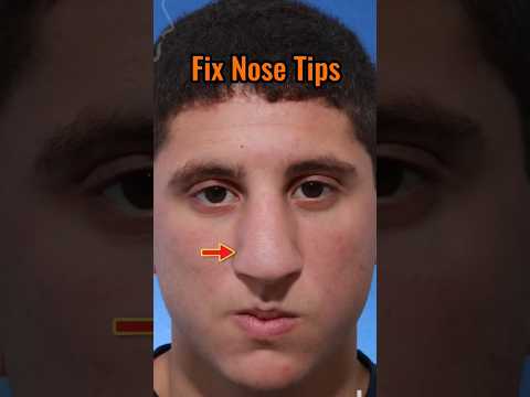 Fix nose tip