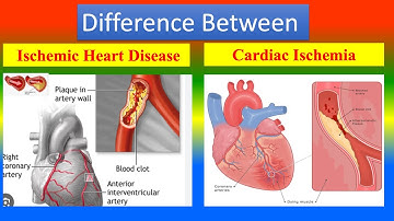 Difference between Ischemic Heart Disease and Cardiac Ischemia
