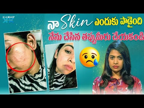 Why is my skin damaged?? Don't make the same mistake I did.
