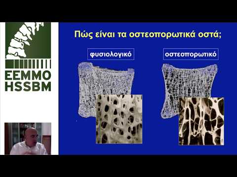 Πολυζώης Μάκρας | Eνδοκρινολόγος - Πρόεδρος ΕΕΜΜΟ