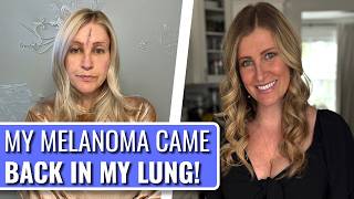 Stage 4 Melanoma Took One Of My Lungs! - Jennifer | Stage 4 Melanoma | The Patient Story