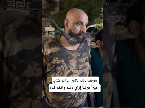 موقف دقنه بالغرا أبو شنب أخيرا عرفنا إزاي دقنه واقفه كده