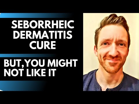 Seborrheic Dermatitis Cure - THIS WORKS! But You Might Not Like It.