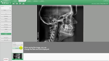 Ezdent I ACQUISITION Tab 04 Import Pano, Ceph, CT Images