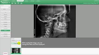 Ezdent I ACQUISITION Tab 04 Import Pano, Ceph, CT Images