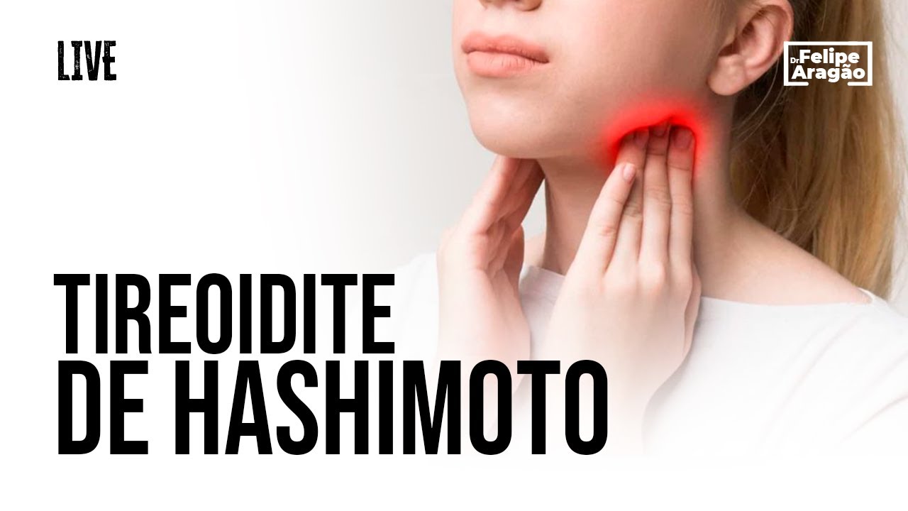 Tireoidite de Hashimoto Live YouTube