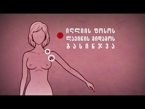 სარძევე ჯირკვლის შეფასება ასაკისა და სქესის შესაბამისად