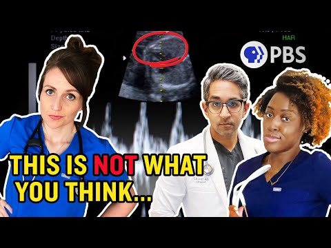 What Most People Get Wrong About Abortion (feat @MamaDoctorJones)