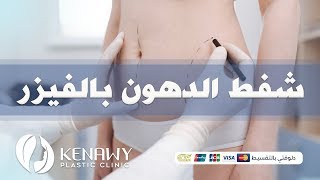 شفط الدهون بالفيزر - صدى البلد