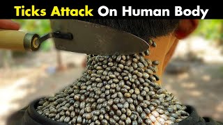 Ticks Bites On Human | Symptoms, Causes And Treatment screenshot 4