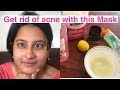 GET RID OF ACNE AND BLACK SPOTS WITH THIS FACE MASK  IN TELUGU