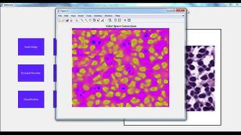 Final Year Ece Projects Based on Image Processing | Final Year Ece Thesis Based on Image Processing