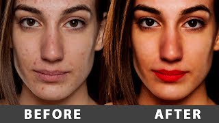 Photoshop Tutorial: Photo Editing & Skin Retouching in Photoshop in Hindi