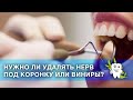 Нужно ли удалять нерв под коронку или виниры? / Препарирование зубов / Удаление нерва