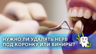 Нужно ли удалять нерв под коронку или виниры? / Препарирование зубов / Удаление нерва