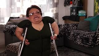 Brenda: Paciente con Síndrome de Morquio by AMIIF Mx 50 views 9 months ago 2 minutes, 37 seconds