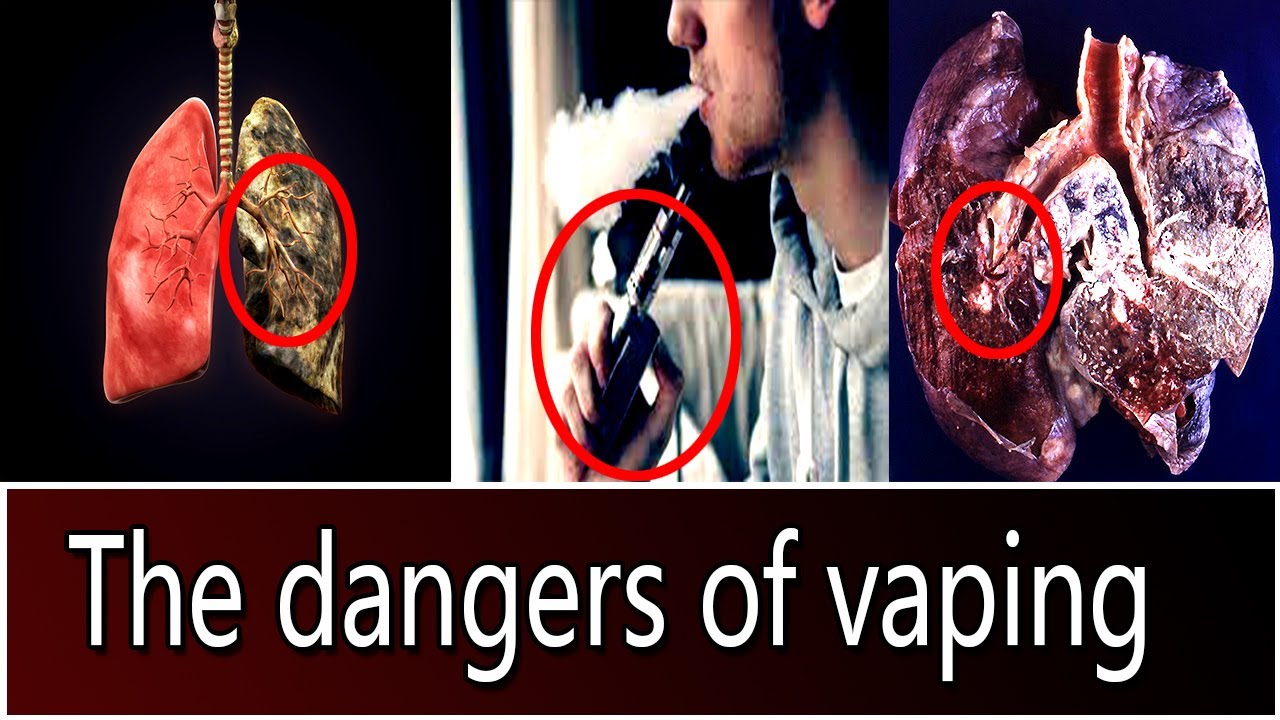 why-vaping-is-dangerous-is-vaping-really-that-bad-for-you-youtube