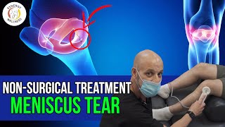Meniscus Tear - Best Non-Surgical Treatment (Cold Laser)