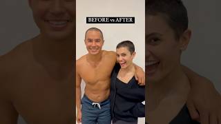 HE SHAVED HIS HEAD FOR HER ❤️🥲❤️