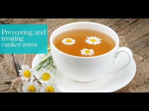 How to prevent and treat canker sores? - Dr Nagy’s Orthodontic Q & A