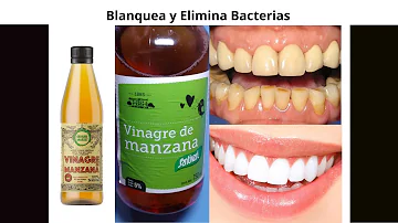 ¿Cómo elimina el vinagre de manzana el sarro de los dientes?