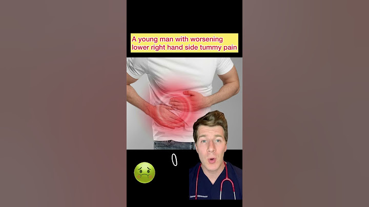 A man with right sided lower abdominal pain…what’s the diagnosis? (PART 1) #shorts #medical #doctor