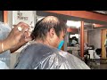 How to cover a large bald spot | how to cover Scarring Alopecia| Alopecia hair transformation