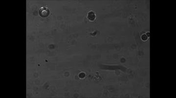 Optical Vortex Tweezers for L= 0, 5, and 8
