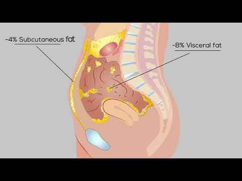 ReduStim Malaysia | Visceral Fat Reduction | Clique Clinic