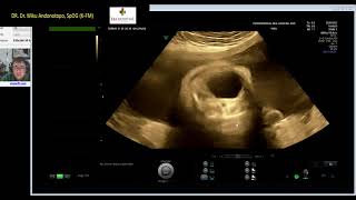 KEHAMILAN NORMAL TRIMESTER III AWAL (Dr Wiku Andonotopo)