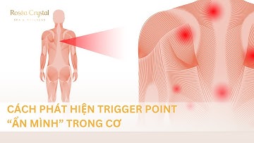 Nhận biết TRIGGER POINT | Thủ phạm "ẨN MÌNH" sau những cơn đau nhức không rõ nguyên nhân