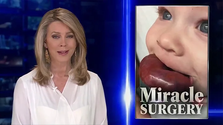 Lip Balloon Surgery | Vascular Surgeon Dr  Milton ...