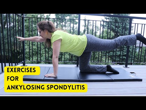 #155 Combat Ankylosing Spondylitis: Discover the Power of 12 Exercises