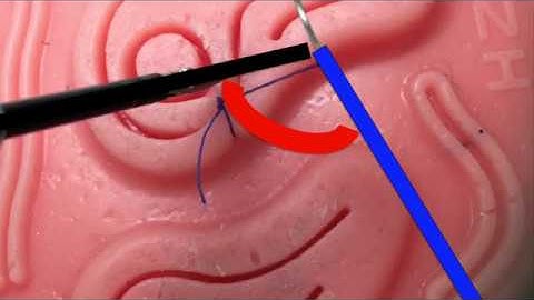 FLS Skills- Laparoscopic Intracorporeal Suturing:Fundamentals and Tips & Tricks for New Learners