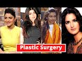 Top 12 Shocking Plastic Surgery Result Of Bollywood Actresses - Deepika Padukone, Rhea Chakraborty