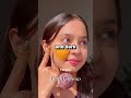 😍✨ Vaseline Beauty Hacks for Dark Circles, Pimples & Pink Lips 💄🔥 #skincare #beautyhacks #shorts