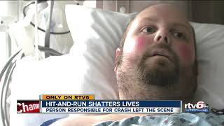 Man injured in hit-and-run speaks from hospital bed