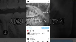 #사랑니발치후기#부산사랑니발치잘하는곳 #부산사랑니당일발치#동래사랑니#마산사랑니#창원사랑니#포항사랑니#경주사랑니#사랑니발치#부산사랑니발치#창원사랑니#울산사랑니#동래임플란트#진주사랑니